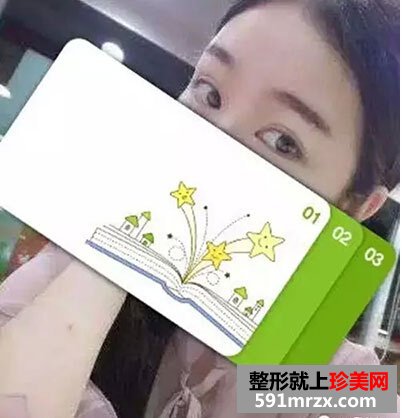 5s重睑术