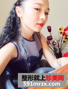 膨体隆鼻需要几天恢复