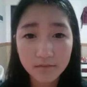 驼峰鼻矫正+双眼皮效果挺不错