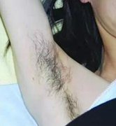 蓝宝石冰点脱毛让我脱颖而出做自信女神