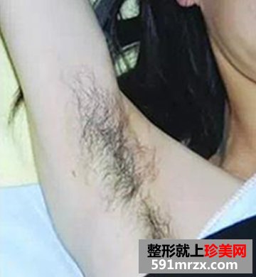 北京冰点脱毛医院,蓝宝石冰点脱毛