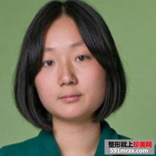 去下颌角,磨骨手术对比照片 圆脸变瓜子脸