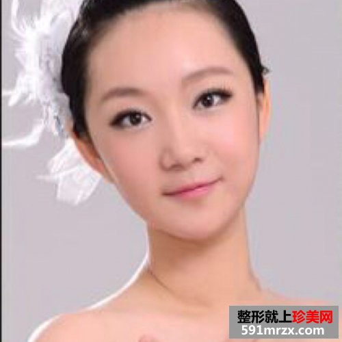 去下颌角,磨骨手术对比照片 圆脸变瓜子脸