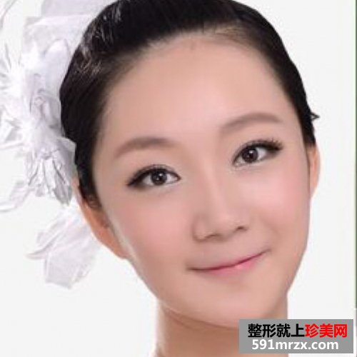 去下颌角,磨骨手术对比照片 圆脸变瓜子脸