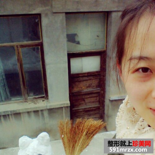 点阵激光祛痘坑