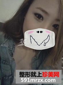 激光去眼袋 让我如愿做个美美的新娘