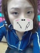 激光去眼袋让我如愿做个美美的新娘