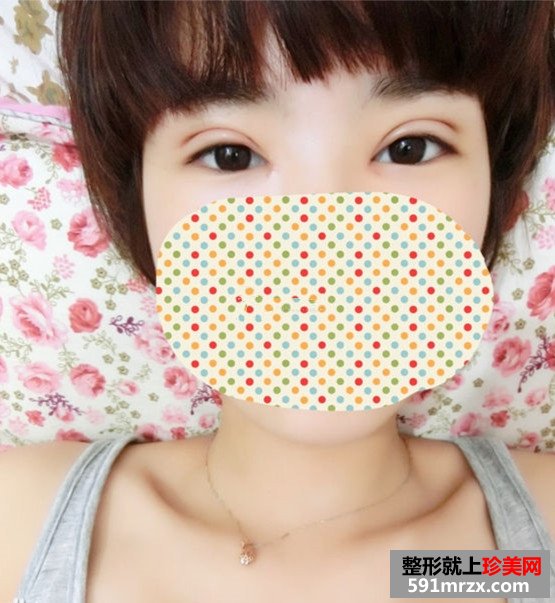 双眼皮失败修复 给我更好看的双眼皮
