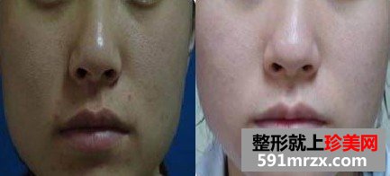 黑脸娃娃效果对比图