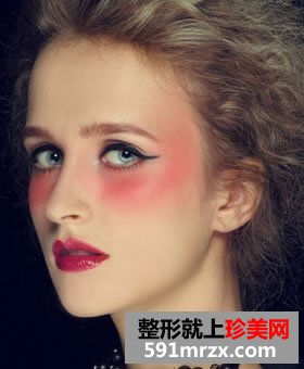 假体隆鼻