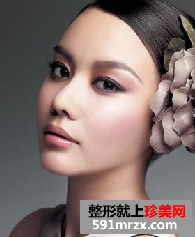 韩式膨体隆鼻