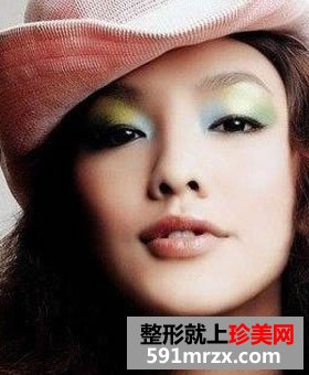 注射隆鼻多少钱