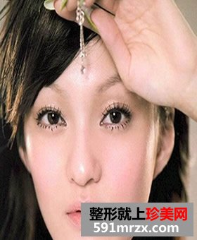 隆鼻恢复时间多长