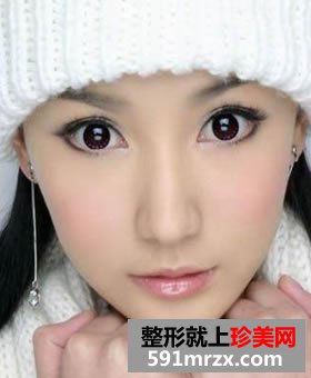 无痕双眼皮要多少钱