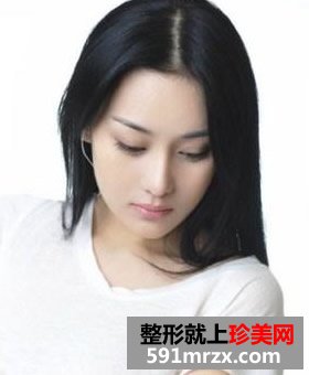 怎样隆鼻最安全