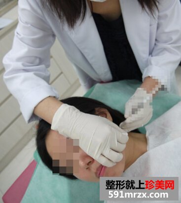 咬肌巨大最终选择注射瘦脸
