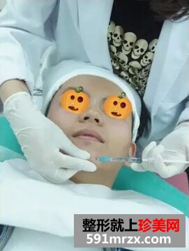 福州武警整形医院玻尿酸隆鼻+调整歪下巴分享 硬汉也爱美