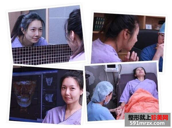 面部轮廓综合整形手术真人案例分享