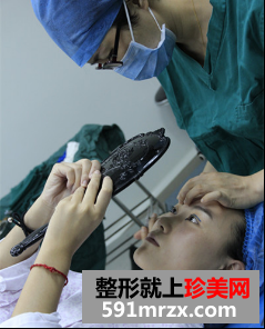 割双眼皮开眼角恢复期经历分享