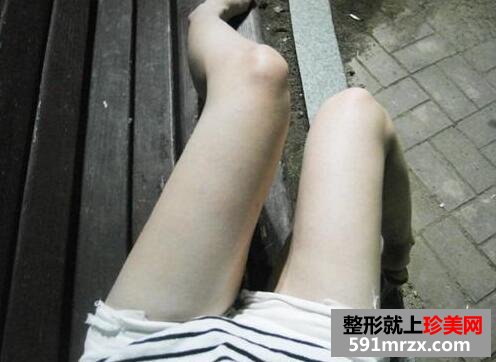 大腿吸脂减肥真实恢复过程对比图