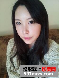 去黑眼圈脸部自体脂肪移植手术真实案例对比图