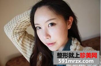 去黑眼圈脸部自体脂肪移植手术真实案例对比图