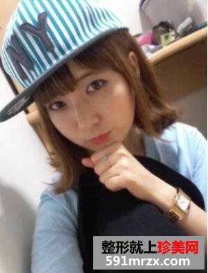 粉红宝宝相媲美 脸部安全整形术后分享