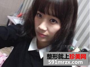 粉红宝宝相媲美 脸部安全整形术后分享