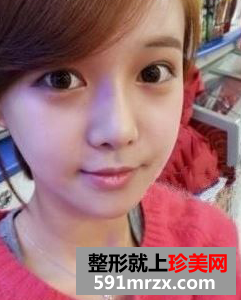 注射胶原蛋白，焕发青春光彩