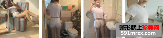 吸脂瘦腰前后对比图，整形对比图，整形案例分享