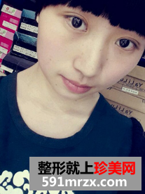 北京医院赵红艺做双眼皮怎么样？赵红艺双眼皮案例