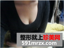 北京八大处李发成自体脂肪丰胸怎么样？李发成丰胸案例