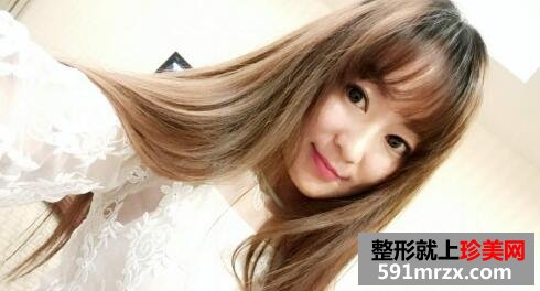 华美整形医院埋线提升除皱抗衰老真实案例分享|面部提升价格