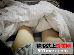大腿+臀部吸脂手术前后效果对比图和恢复过程