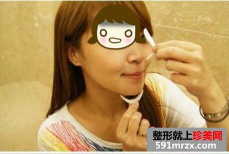做完膨体隆鼻颜值UP! 膨体隆鼻恢复图