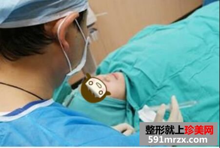 做完膨体隆鼻颜值UP! 膨体隆鼻恢复图