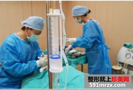 做完膨体隆鼻颜值UP! 膨体隆鼻恢复图
