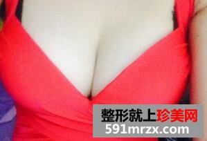 假体隆胸术后恢复图