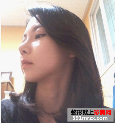 图片17.png