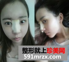 图片31.png