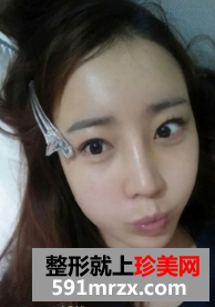 图片33.png