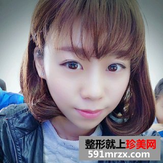 打瘦脸针除咬肌前后效果对比图和恢复过程