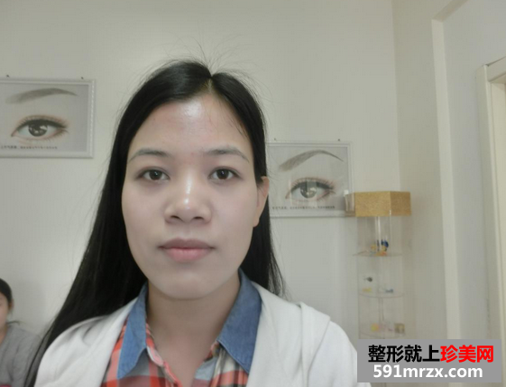 韩式雾眉图片对比照片效果分享，还有恢复过程哦！