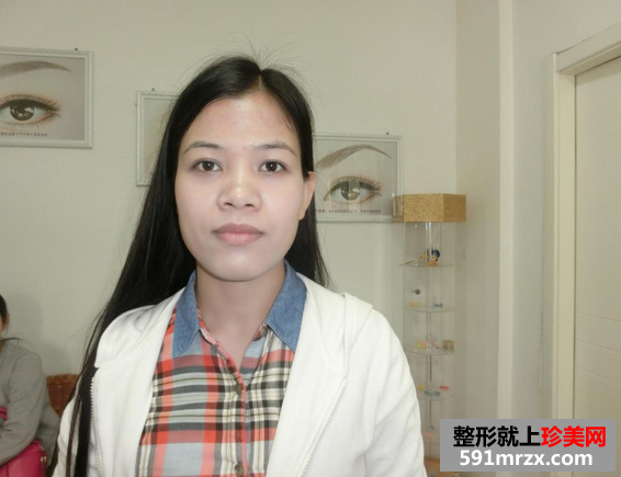 韩式雾眉图片对比照片效果分享，还有恢复过程哦！