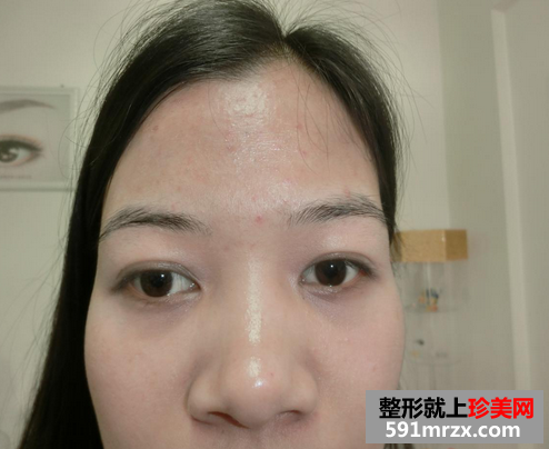 韩式雾眉图片对比照片效果分享，还有恢复过程哦！