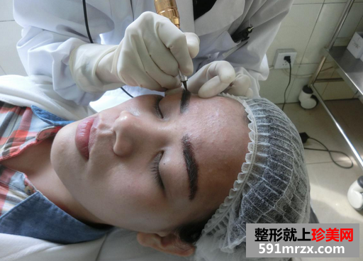 韩式雾眉图片对比照片效果分享，还有恢复过程哦！