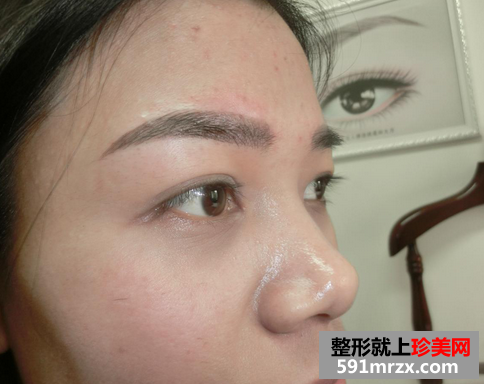 韩式雾眉图片对比照片效果分享，还有恢复过程哦！