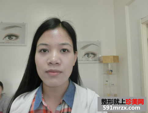 韩式雾眉图片对比照片效果分享，还有恢复过程哦！