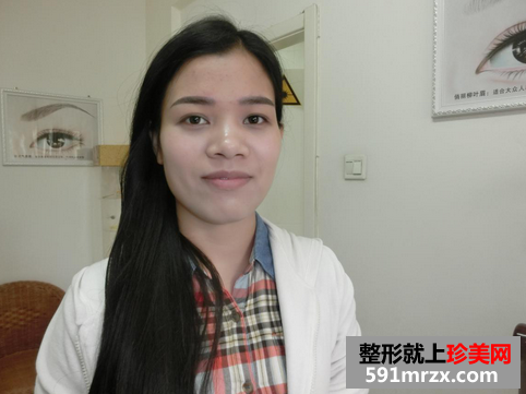 韩式雾眉图片对比照片效果分享，还有恢复过程哦！