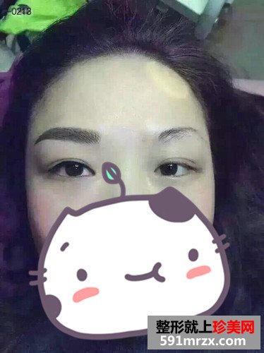 韩式半永久化妆术（韩式半永久纹眉）前后对比效果图片分享